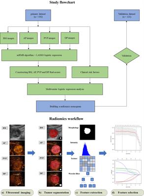 Preoperative Prediction of Microvascular Invasion in Patients With Hepatocellular Carcinoma Based on Radiomics Nomogram Using Contrast-Enhanced Ultrasound